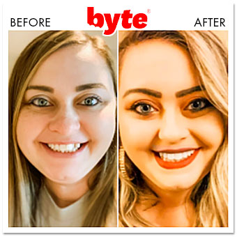 byte before after erin