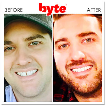byte before after jeff