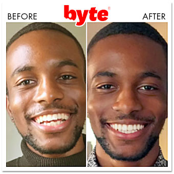 byte before after michael