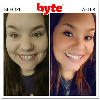 byte before after sarah